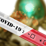 covid-19-5663977_1920.jpg